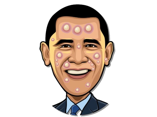 Read more about the article Celebrity Pimple Pop